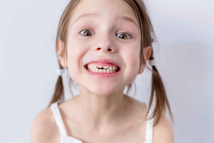 Dientes De Leche