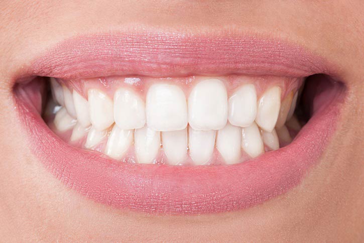 Oclusión Dental