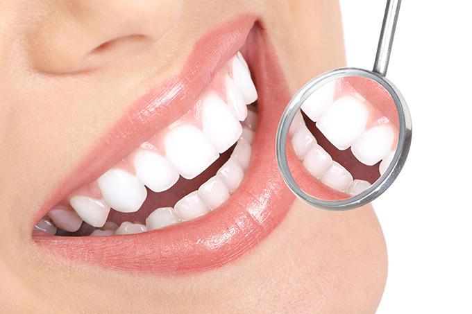 Placa Y Calculo Dental